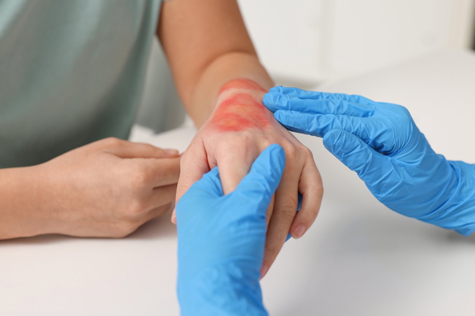 Wound Care
